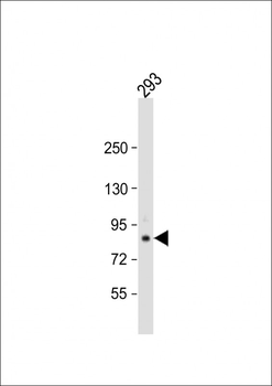 TARSL2 Antibody (Center)