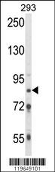 TARSL2 Antibody (C-term)