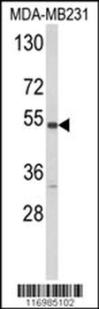 CYP2A13 Antibody (C-term)