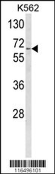 CYP4F3 Antibody (N-term)