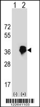 MLX Antibody (Center)