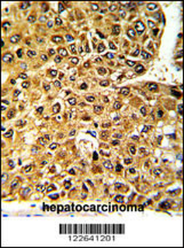 MLX Antibody (Center)