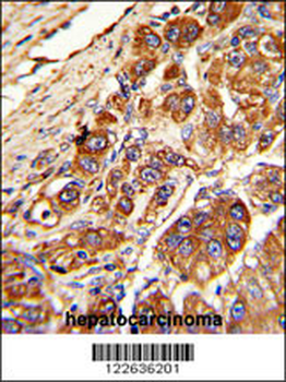 KLC1 Antibody (Center)
