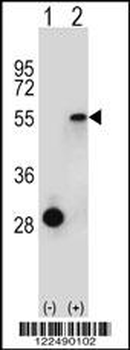 ESRRA Antibody (Center)