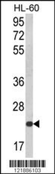 KLRC2 Antibody (N-term)