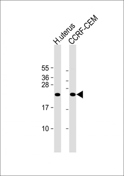 KLRC2 Antibody (N-term)