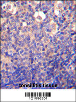 KLRC2 Antibody (N-term)
