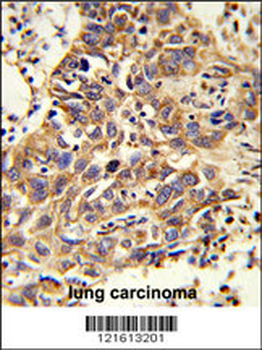 CAT Antibody (Center)
