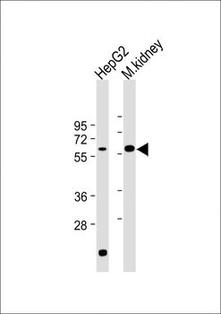 CAT Antibody (Center)