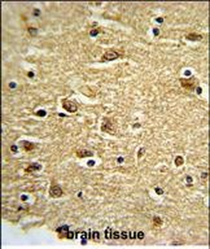 PTK2 Antibody (C-term)