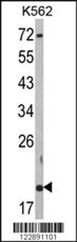 RNF5 Antibody (N-term)