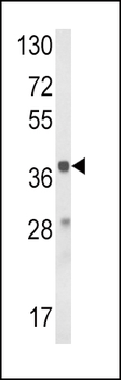HAO1 Antibody (Center)
