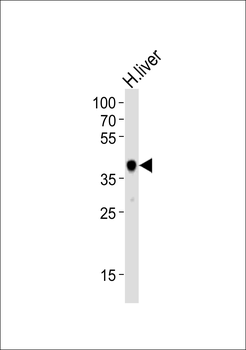 HAO1 Antibody (Center)