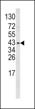 WNT5B Antibody (Center)