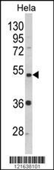 PPP2R2B Antibody (Center)