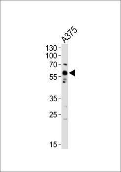 SRC Antibody (Y419)