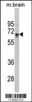ZMYND11 Antibody (N-term)