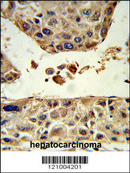 HPD Antibody (C-term)