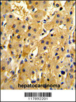 HPD Antibody (N-term)