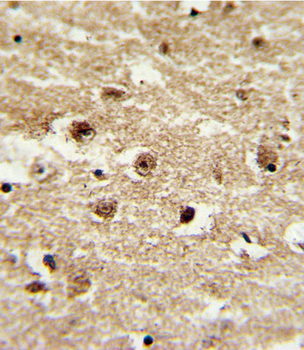 IGFBP2 Antibody (C-term)