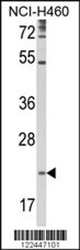 TSPAN31 Antibody (Center)