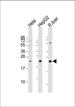 TSPAN31 Antibody (Center)