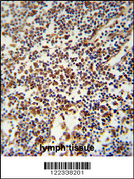 USF2 Antibody (Center)