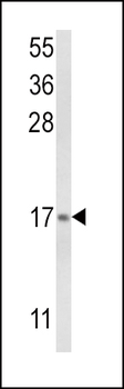 LTC4S Antibody (N-term)