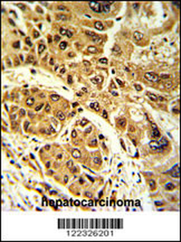LPIN2 Antibody (Center)