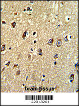 ABCC5 Antibody (Center)