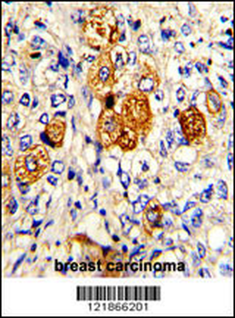 C5 Antibody (N-term)