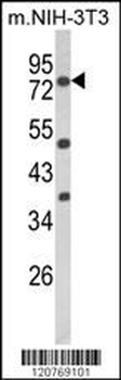 PRKCA Antibody (N-term)
