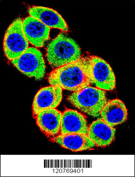PRKCA Antibody (N-term)
