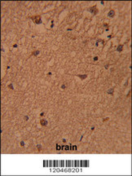 HSPC142 Antibody (Center)