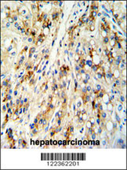 CECR5 Antibody (Center)
