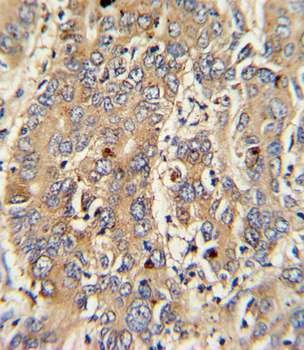 PIGR Antibody (C-term)