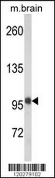 VPS53 Antibody (N-term)
