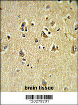 VPS53 Antibody (N-term)