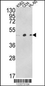ACTR3B Antibody (C-term)