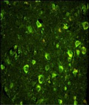 ABI1 Antibody (N-term)
