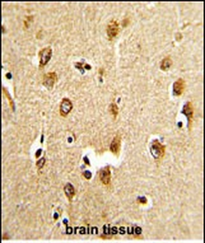 ABI1 Antibody (N-term)