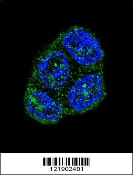 FAS Antibody (Center)