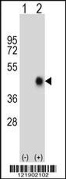 FAS Antibody (Center)