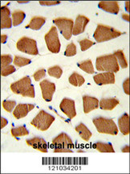 TBC1D4 Antibody (N-term)