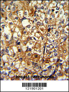 ACTN1 Antibody (N-term)
