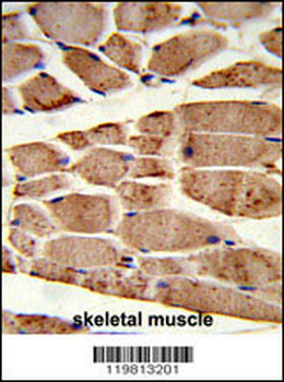 RANBP9 Antibody (Center)