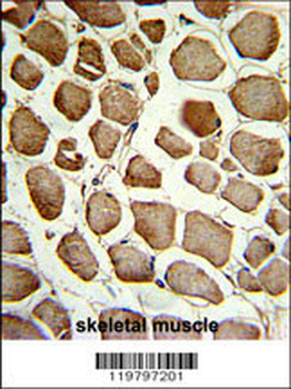 CKIP-1 Antibody (N-term)