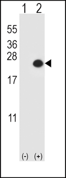 DUSP3 Antibody (N-term)