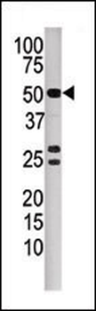 PPP3CB Antibody (N-term)