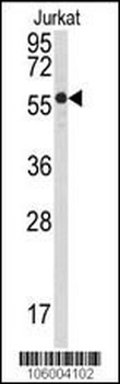PPP3CB Antibody (N-term)